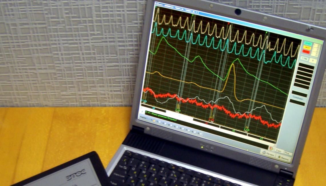 Computer-based polygraph display